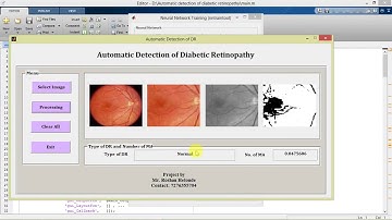 Diabetic Retinopathy Detection and Classification in Fundus Images Using Matlab Project Code