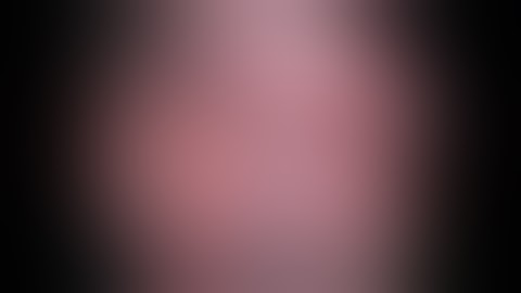 Medial to lateral or proximal to distal Sylvian dissection Prof. Aadil S Chagla