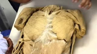 Anatomy Lab - 3 - Chest Muscles