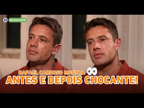 Rafael Cardoso shows physical transformation after rehab and 3 months of sobriety: 'you have to p...