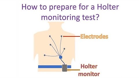 How to prepare for a Holter monitoring test