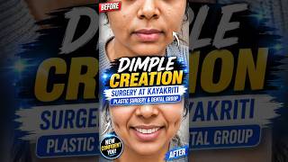 Before & After Dimple Creation Surgery | Amazing Transformation