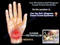 Patient Self Diagnose Carpal Tunnel Syndrome - Everything You Need To Know - Dr. Nabil Ebraheim