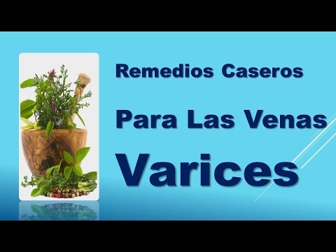 venas varices en ingles Remedios Caseros Para Las Venas Varices