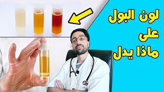 لون البول | لا تتجاهل لون البول عندك - قد يكون إلتهاب الكبد أو حصى الكلى