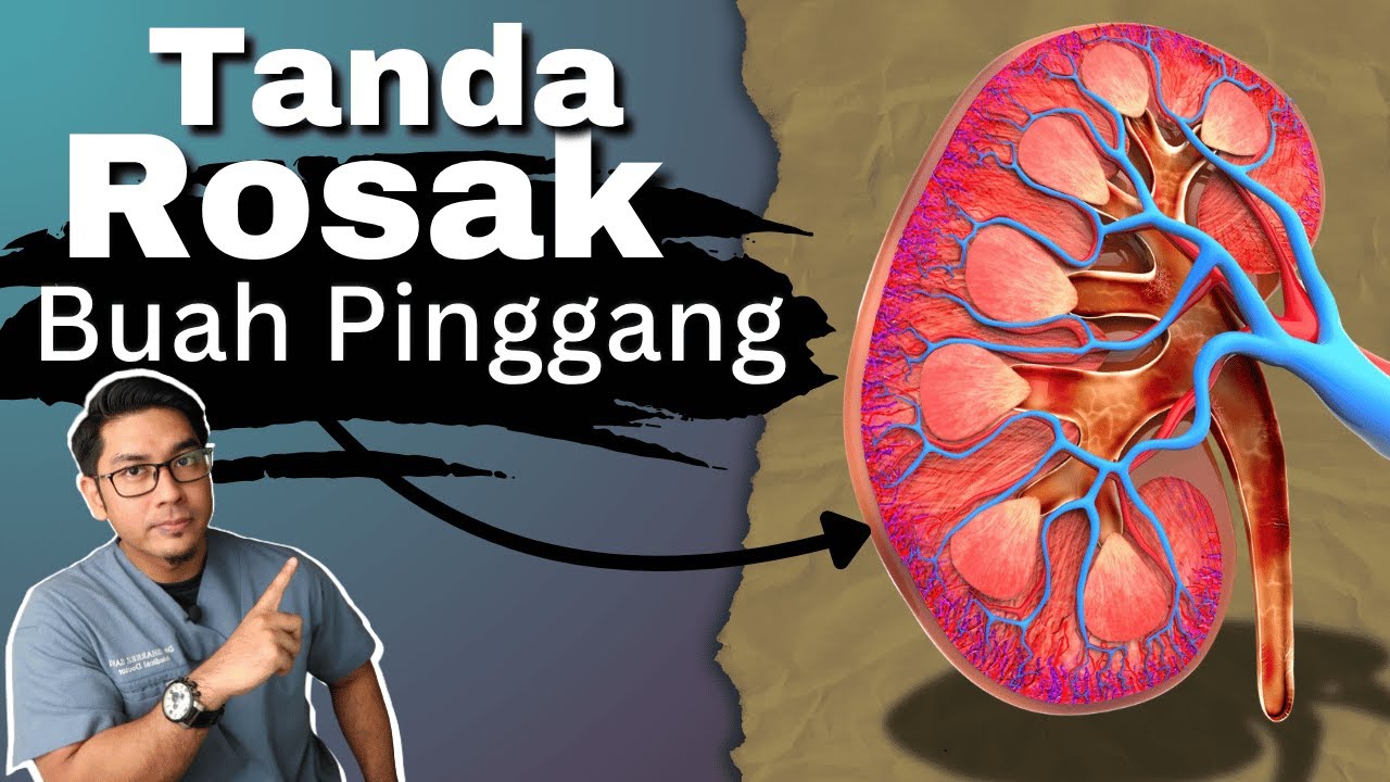 5 Tanda Awal Buah Pinggang Rosak | Jangan Abaikan | Doctor Sani |
