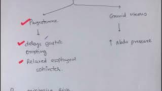 Mendelsson Syndrome [ Aspiration Pneumonitis ]