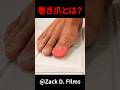 巻き爪とは? #shorts