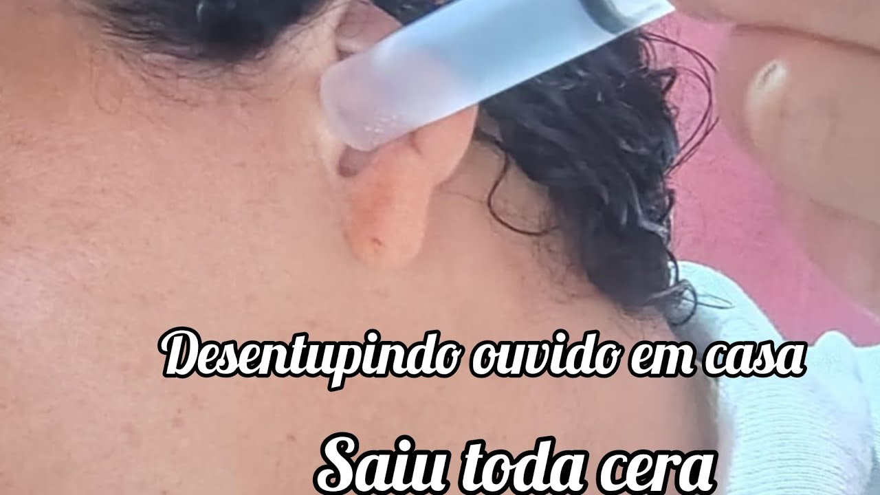 Ouvido entupido 😨!Como desentupir ouvido em casa . - YouTube