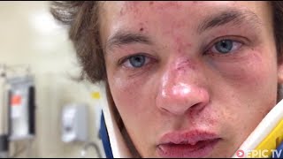 Celebrity MTB Head Injury at Redbull Joyride, Recovery | Brayden Barrett-Hay: reGAINING PSYCHE, Ep. 1 Net Worth