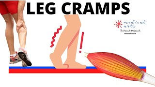 Leg Cramps, Muscle Spasms: Definition, Causes, Treatment, Prevention.