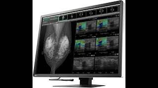 12 Megapixels on a 31-Inch Screen EIZO RX1270 Explained