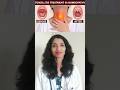 Treat Tonsillitis With Homeopathic #odia #health #shorts #tonsils #Tonsillitis