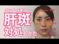 【肝斑】そのシミ肝斑?なくなるの?意外と知られていない事実も/みのりエステ先生