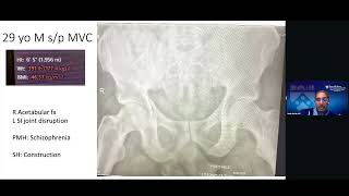 Dr. Samir Mehta OTA 2024 Virtual Webinar: Antegrade Posterior Column Screw: A Percutaneous Technique