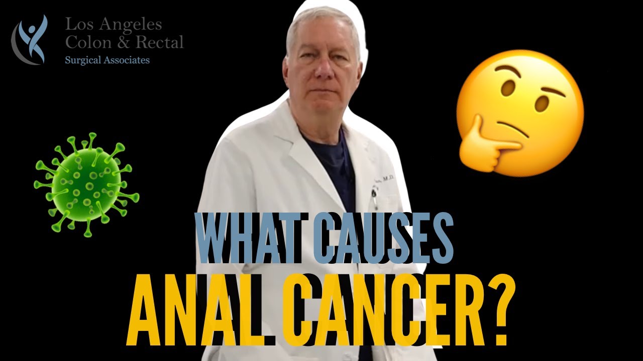What Causes Anal Cancer Youtube