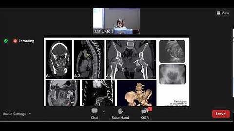 Cập nhật kiến thức và kỹ năng xử trí các bệnh lý cấp cứu thường gặp phần 4