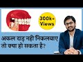 अक्कल दाढ निकलवाए या नहीं ? अक्कल दाढ़ दर्द  का इलाज | Wisdom Teeth Removal | by Dr Ankit SERAPHIC