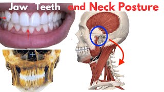 How Your Jaw and Teeth Influence Your Posture: What no one talks about!