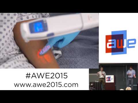 Joe Zott and Vinny Luciano (Accuvein) - Projecting veins on the skin at AWE 2015