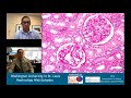 Web Episode 020 Unusual AKI With Drs Rodby Baxi And Cimbaluk From Rush Web Episode 020 Unusual AKI With Drs Rodby Baxi And Cimbaluk From Rush