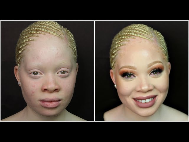 Sætte Giraf bur Amazing make-up transformation on Albino Skin - YouTube