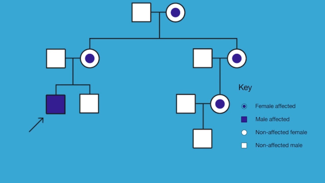 Pedigree Analysis Improving diagnosis of Fabry disease YouTube