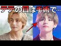 【BTS】テテの目について､美容外科医が衝撃の真実について告白