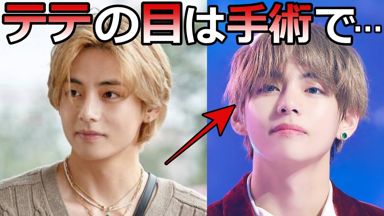 BTS】テテの目について､美容外科医が衝撃の真実について告白 - YouTube
