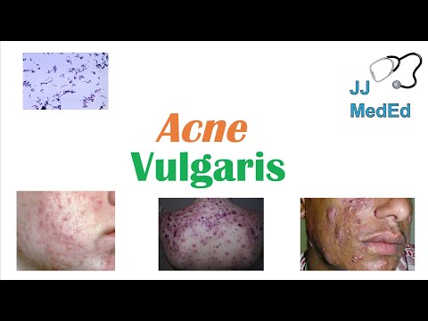 Video: No kurienes rodas acne vulgaris?