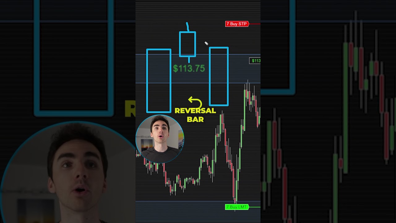 Why Your Trades Are Losing