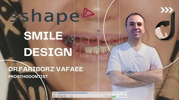 Smile design tutorial in 3shape unite (part1)