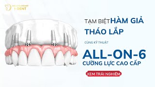 Tạm Biệt Hàm Giả – Trồng Răng All-on-6 Sau 3 Ngày Có Răng
