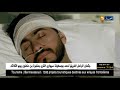 تامر حسني يدخل المستشفى بسبب إلتهاب حاد في الأحبال الصوتية تامر حسني يدخل المستشفى بسبب إلتهاب حاد في الأحبال الصوتية