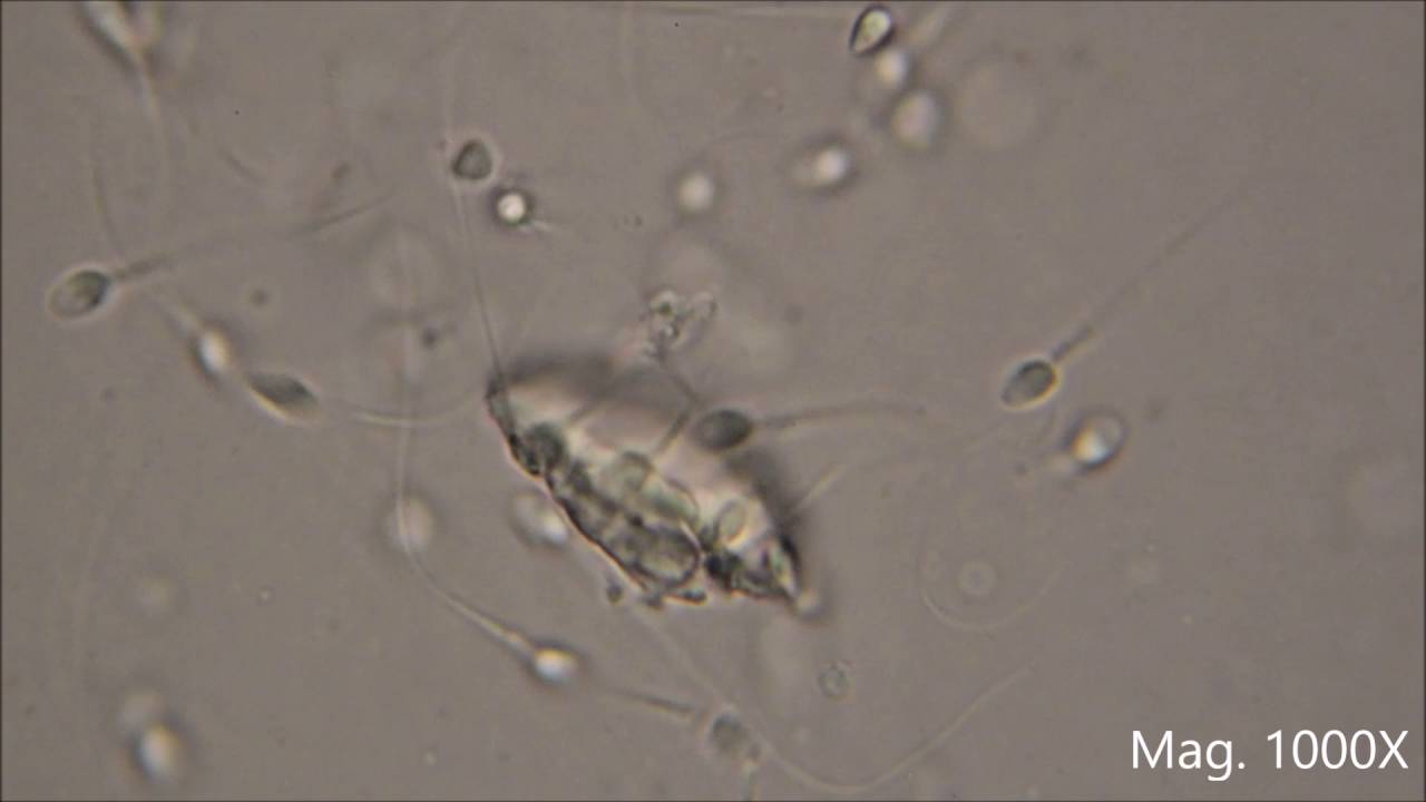 Human Sperm under the Microscope - YouTube
