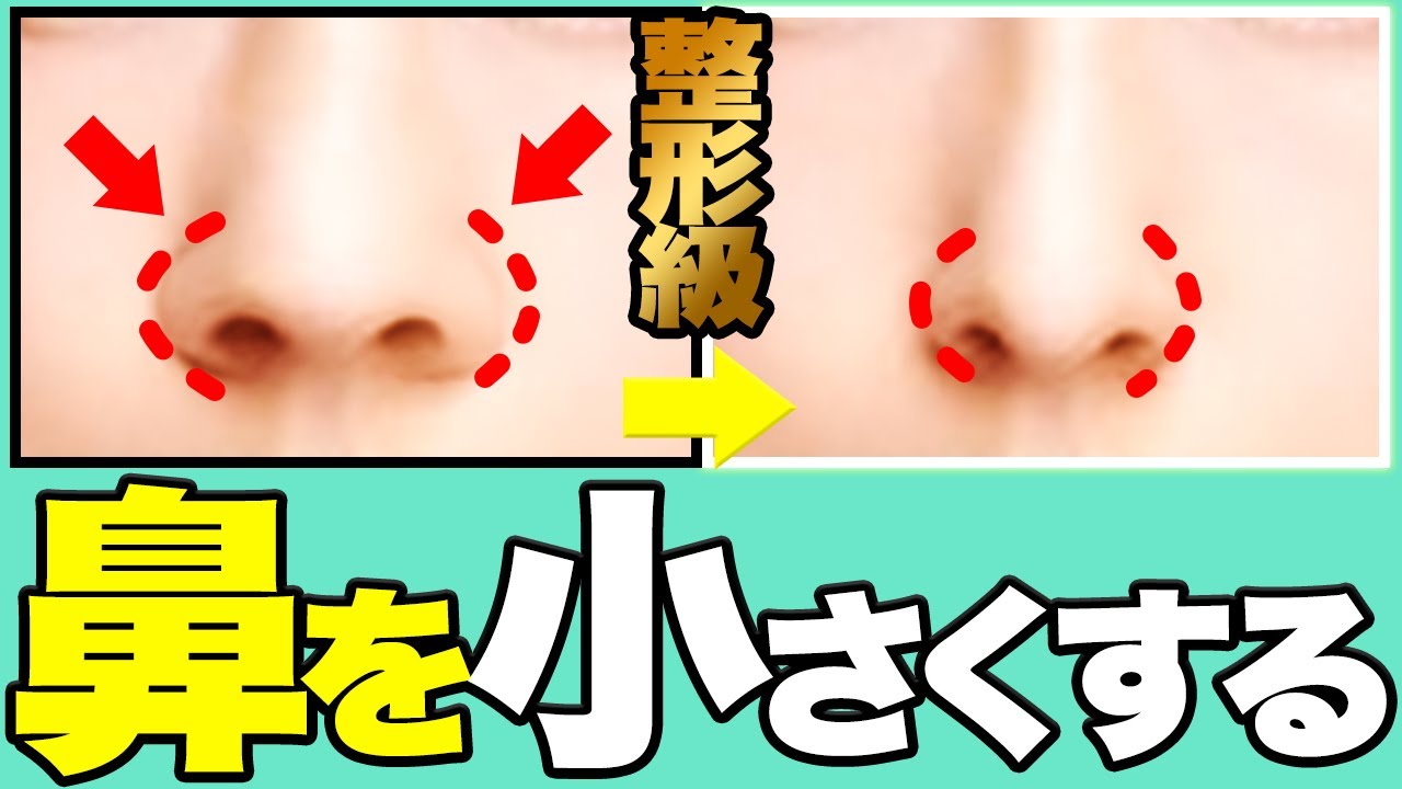 整形級 絶対に鼻を小さくする方法 ニンニク鼻卒業 Youtube