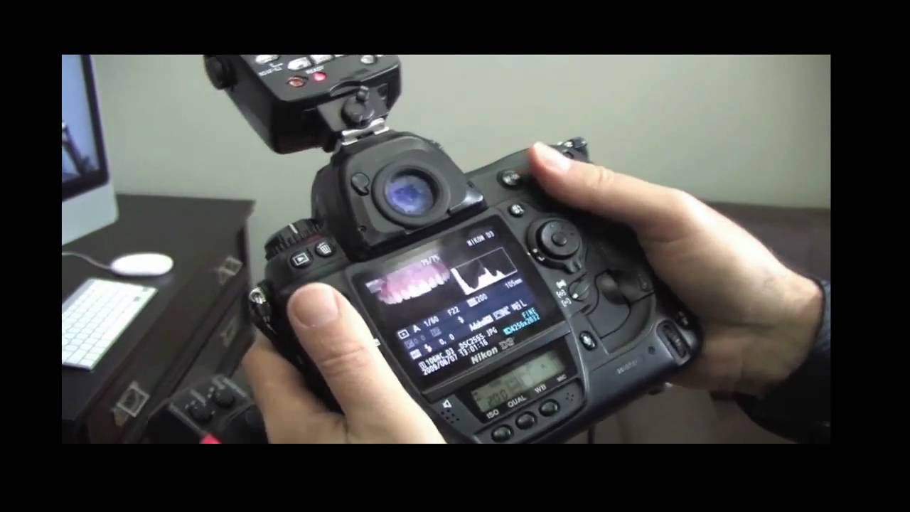 Share 140+ ring flash for dental photography latest netgroup.edu.vn