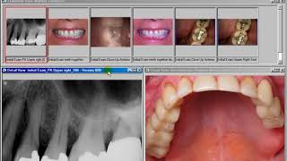 Desco Dental - Imaging Overview screenshot 3