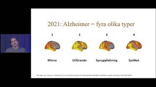 Vad är mest typiska symptomen i början av Alzheimers sjukdom?