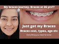 Just got my braces | Adult Braces | Cost in India, age for braces, types of braces etc