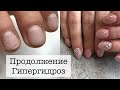 ГИПЕРГИДРОЗ КЕРАТОЗ РУК НОГТЕЙ МАНИКЮР ГЕЛЕМ PATRISA NAIL