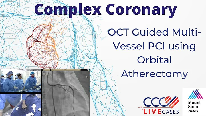OCT Guided Multi-Vessel PCI using Orbital Atherectomy - March 19, 2019