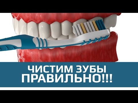 Чистка зубов. Правильная и неправильная чистка зубов