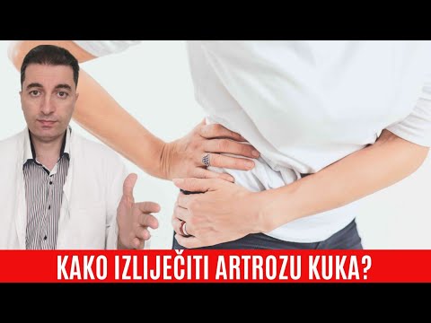 Kako izliječiti ARTROZU KUKA?