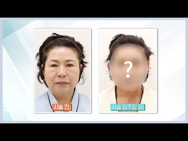 [NOTE.PRS] 나도 갖고싶다 동안얼굴! 그 비결은?