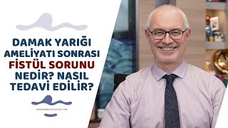 Damak Yarığı Ameliyatı Sonrası Fistül Sorunu Nedir? Nasıl Tedavi Edilir? - Prof. Dr. Hakan Ağır