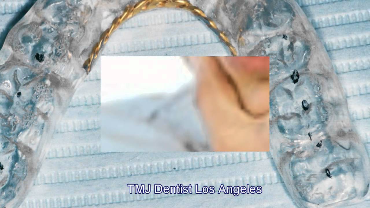 TMJ Dentist Los Angeles