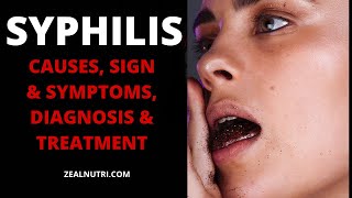 Syphilis: A Complete Guide to the Disease, Prevention, and Treatment