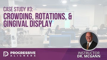 Case Study #3: Crowding, Rotations, & Gingival Display | Dr. McGann