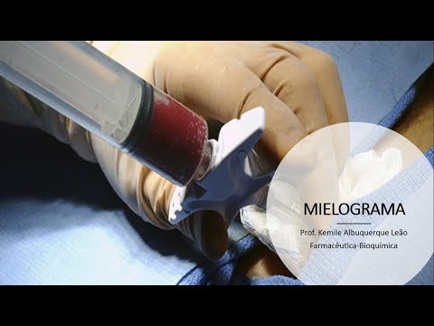 MIELOGRAMA: Técnica e interpretação